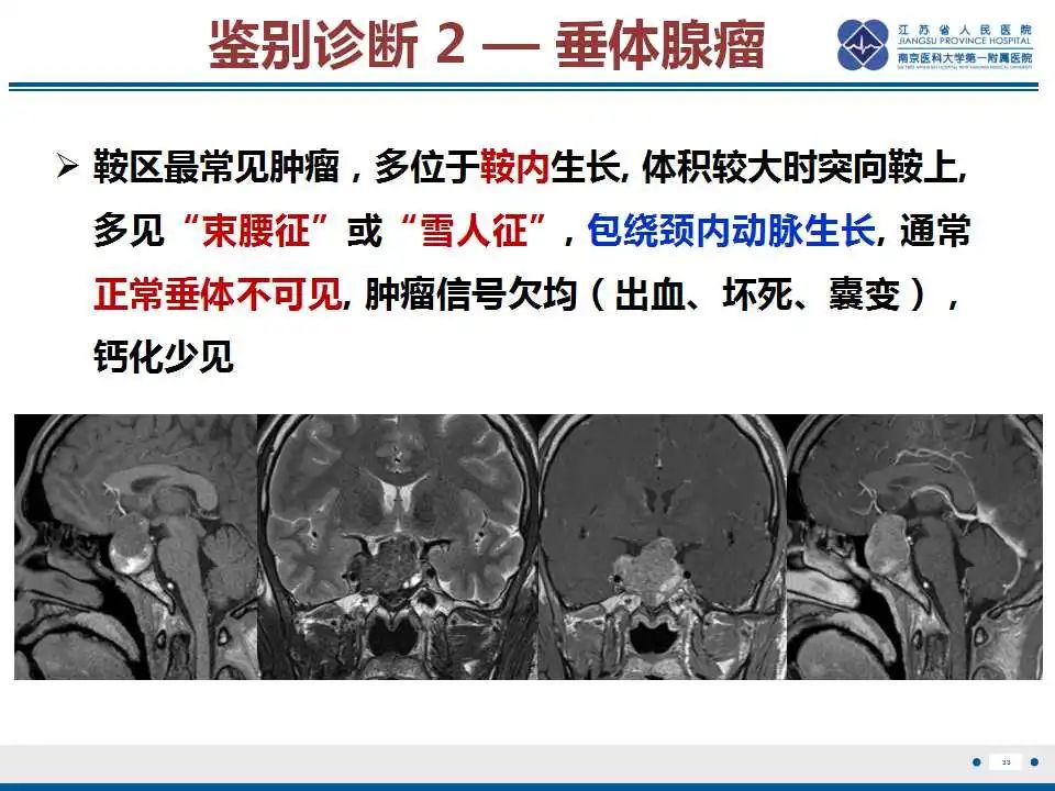 影像PPT - 【PPT】神经垂体颗粒细胞瘤-34