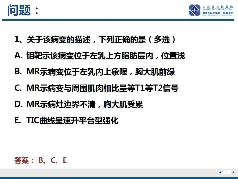 影像PPT - 【PPT】乳腺颗粒细胞瘤-9