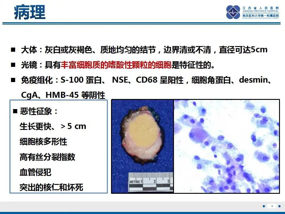 影像PPT - 【PPT】乳腺颗粒细胞瘤-16
