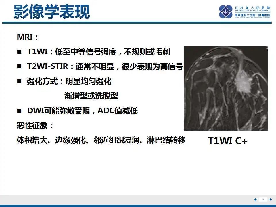 影像PPT - 【PPT】乳腺颗粒细胞瘤-26