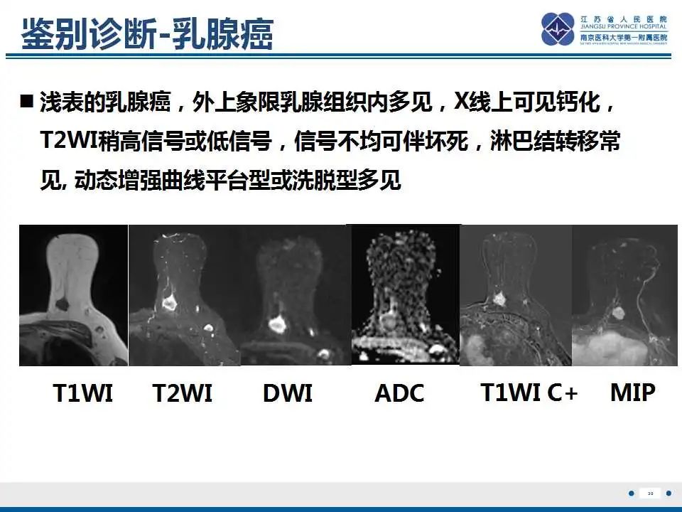 影像PPT - 【PPT】乳腺颗粒细胞瘤-31