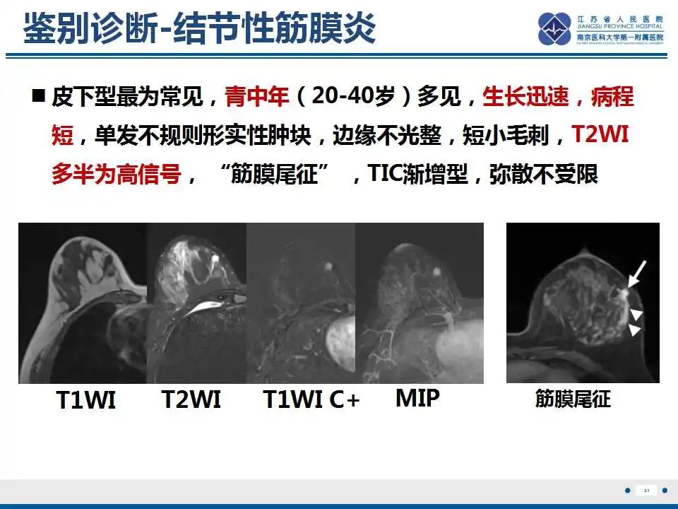 影像PPT - 【PPT】乳腺颗粒细胞瘤-32