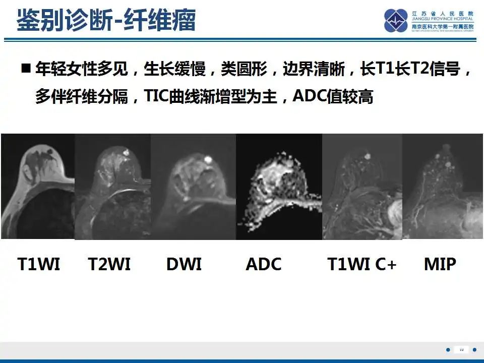 影像PPT - 【PPT】乳腺颗粒细胞瘤-33