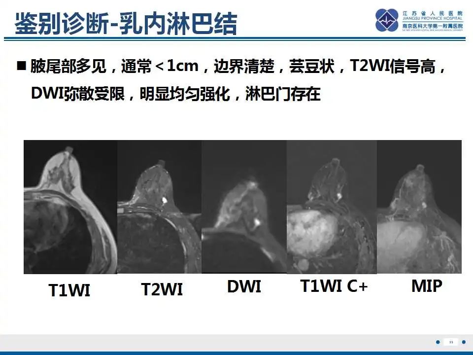 影像PPT - 【PPT】乳腺颗粒细胞瘤-34