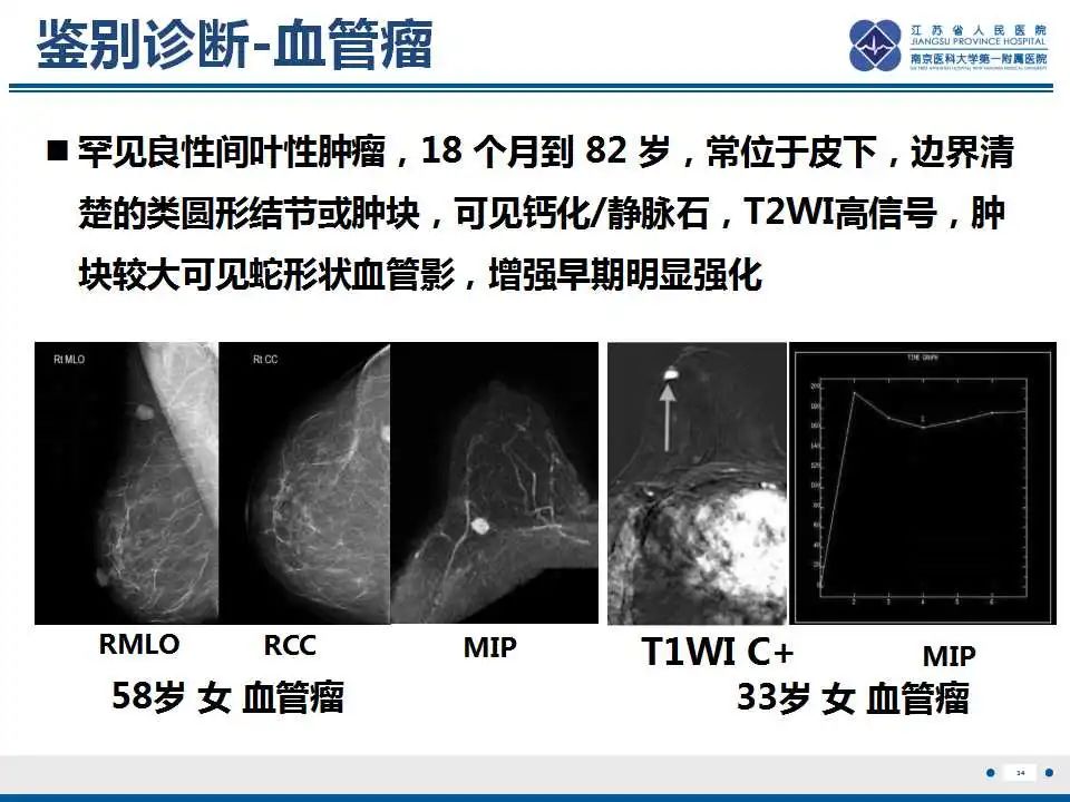 影像PPT - 【PPT】乳腺颗粒细胞瘤-35