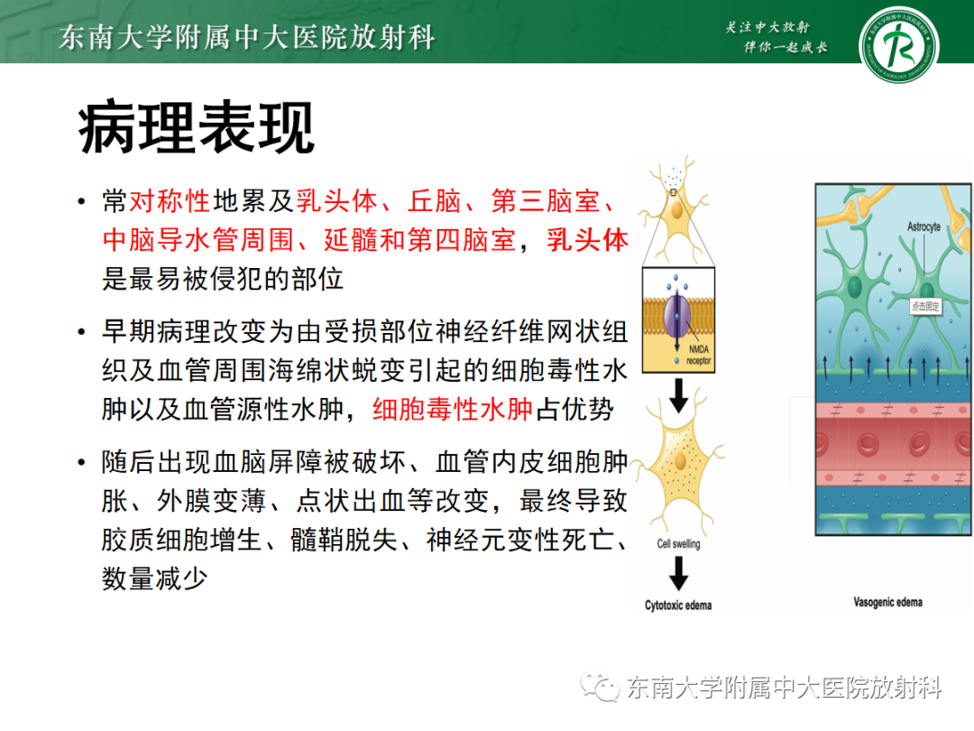 影像PPT - 【PPT】Wernicke脑病-8