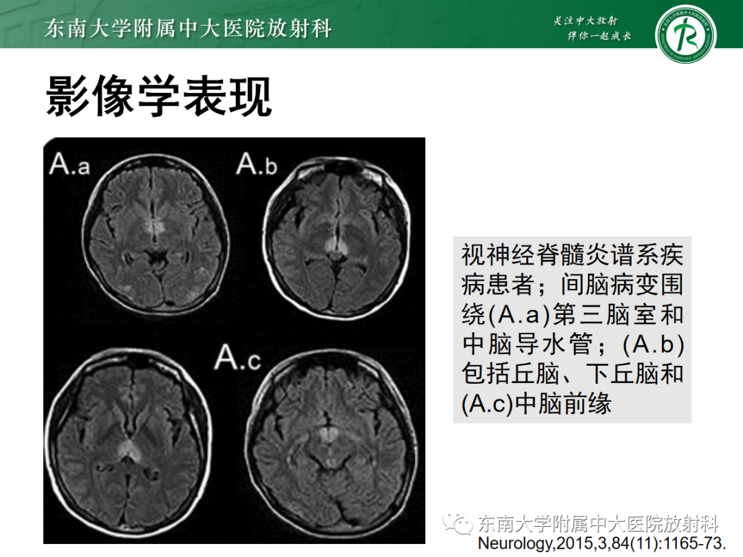 影像PPT - 【PPT】Wernicke脑病-24