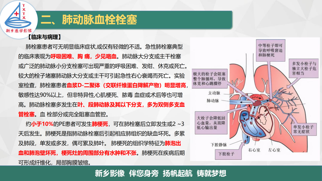 影像PPT - 【PPT】医学影像诊断学教材解读—肺循环病变的影像表现-8