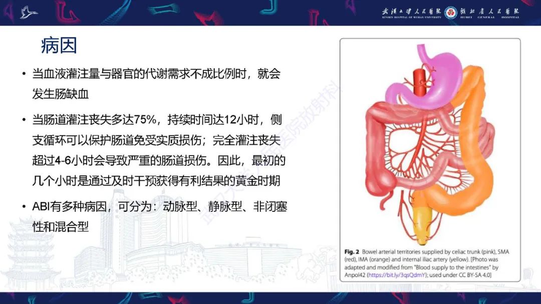 影像PPT - 【PPT】急性肠缺血影像诊断-9