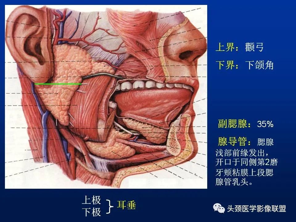 影像PPT - 【PPT】腮腺病变影像学诊断-2
