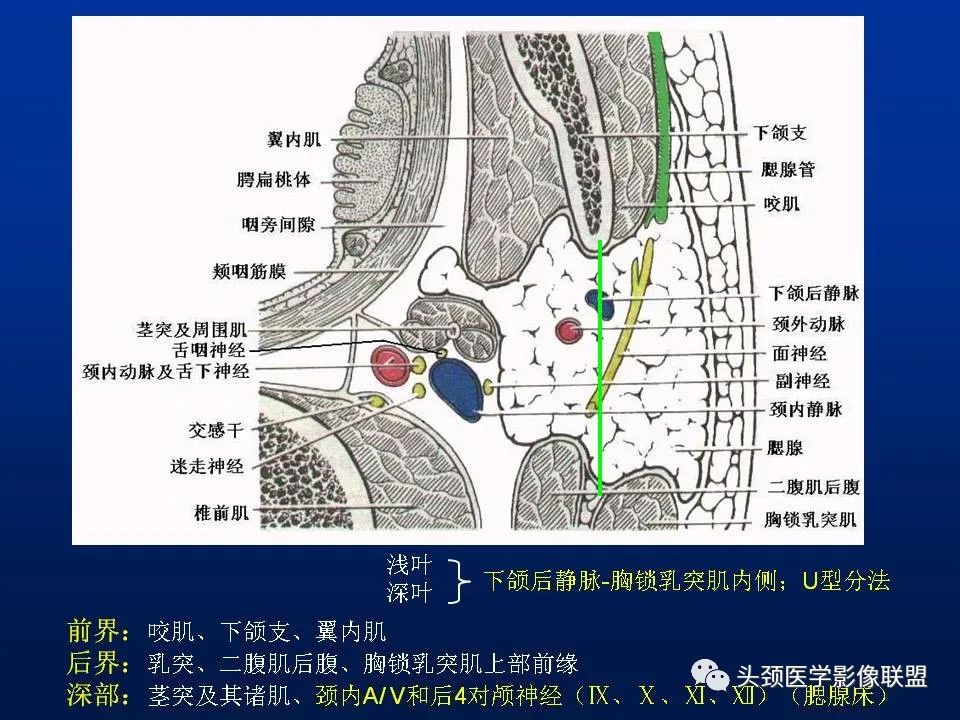 影像PPT - 【PPT】腮腺病变影像学诊断-3