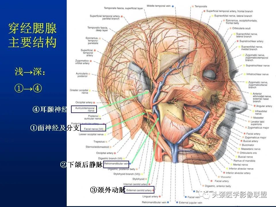 影像PPT - 【PPT】腮腺病变影像学诊断-4