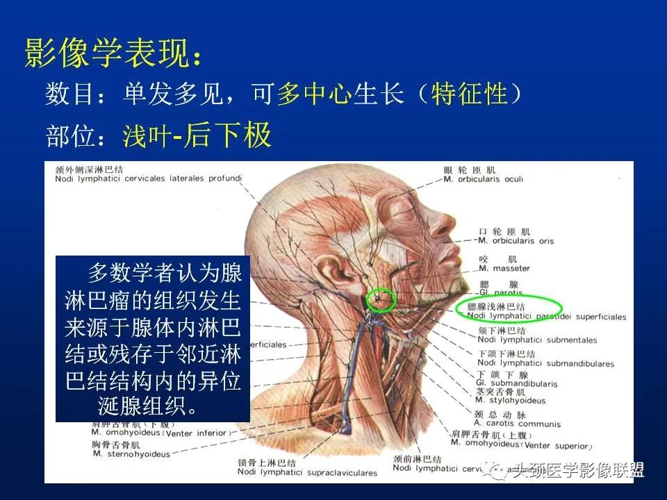 影像PPT - 【PPT】腮腺病变影像学诊断-9