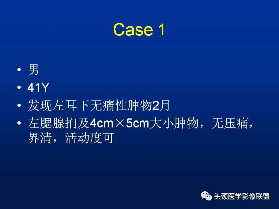 影像PPT - 【PPT】腮腺病变影像学诊断-13