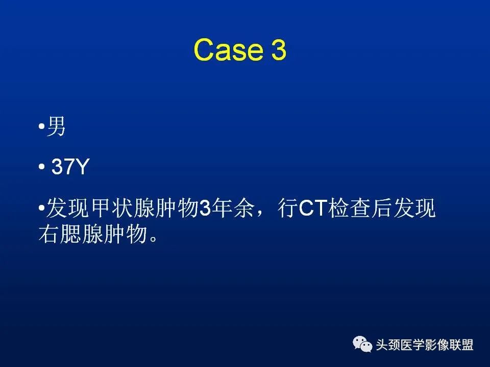 影像PPT - 【PPT】腮腺病变影像学诊断-23