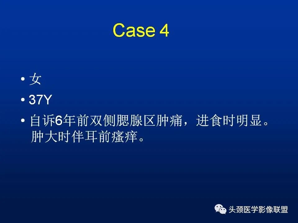 影像PPT - 【PPT】腮腺病变影像学诊断-30