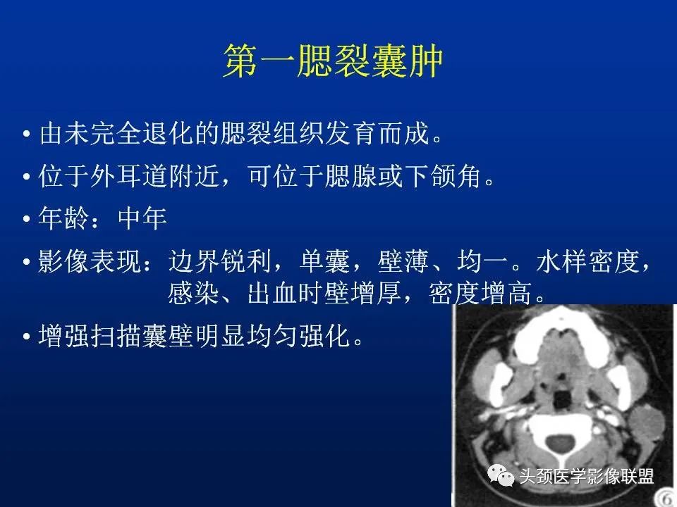 影像PPT - 【PPT】腮腺病变影像学诊断-36