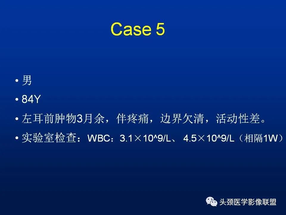 影像PPT - 【PPT】腮腺病变影像学诊断-41