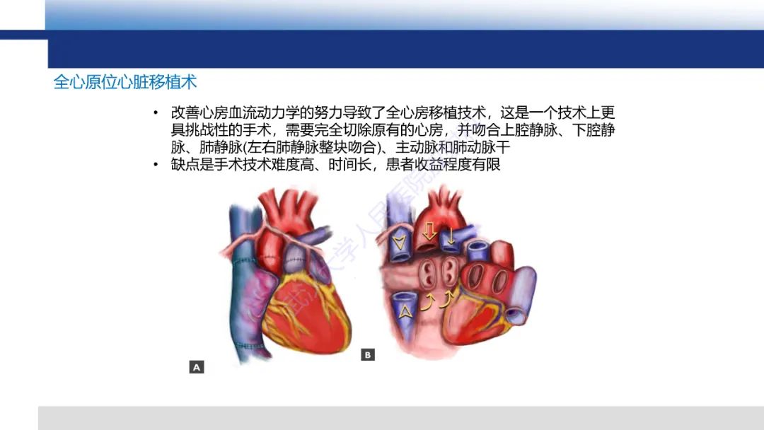 影像PPT - 【PPT】心脏原位移植术后影像学评估-6
