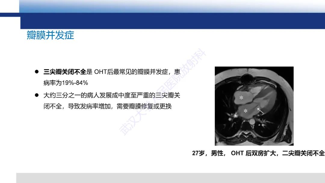 影像PPT - 【PPT】心脏原位移植术后影像学评估-22