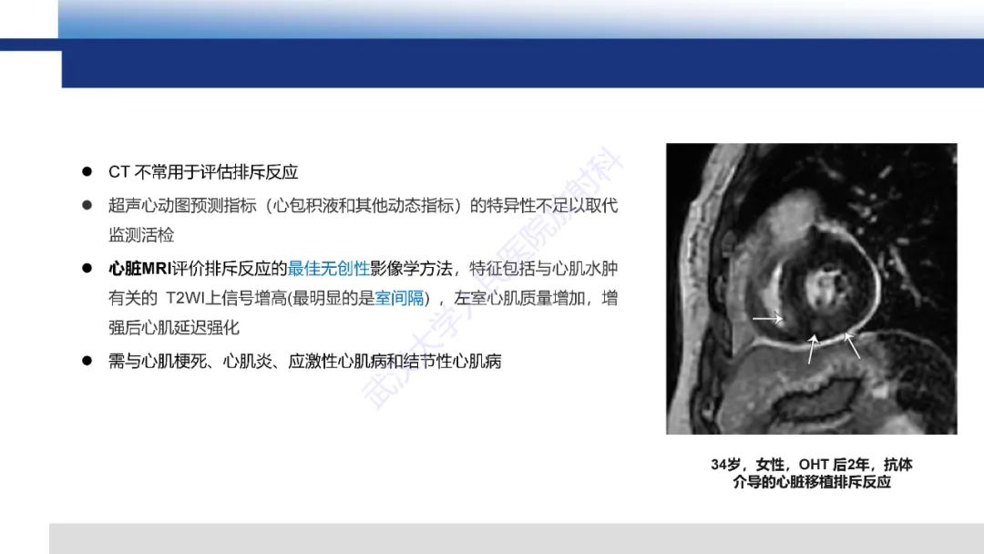 影像PPT - 【PPT】心脏原位移植术后影像学评估-21