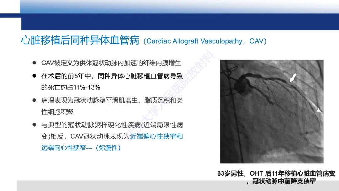 影像PPT - 【PPT】心脏原位移植术后影像学评估-26