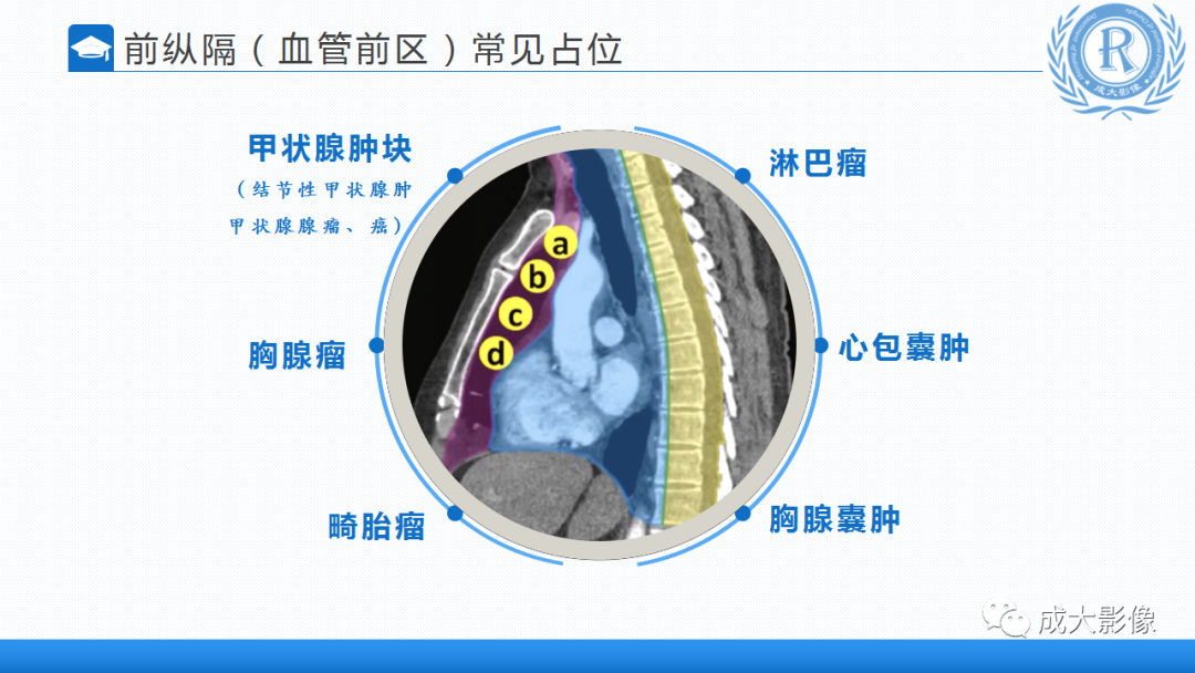 影像PPT - 【PPT】纵隔常见肿瘤及瘤样病变的诊断思路-9