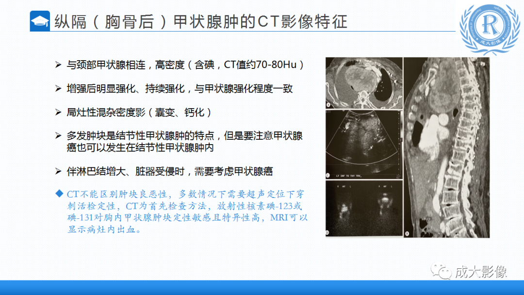 影像PPT - 【PPT】纵隔常见肿瘤及瘤样病变的诊断思路-11