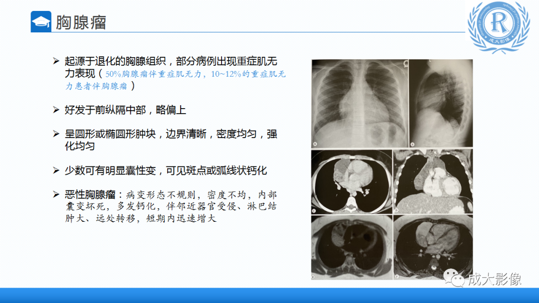 影像PPT - 【PPT】纵隔常见肿瘤及瘤样病变的诊断思路-13