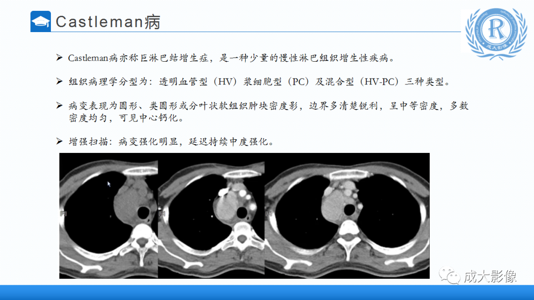 影像PPT - 【PPT】纵隔常见肿瘤及瘤样病变的诊断思路-31