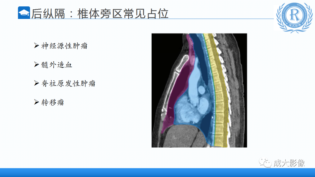 影像PPT - 【PPT】纵隔常见肿瘤及瘤样病变的诊断思路-35