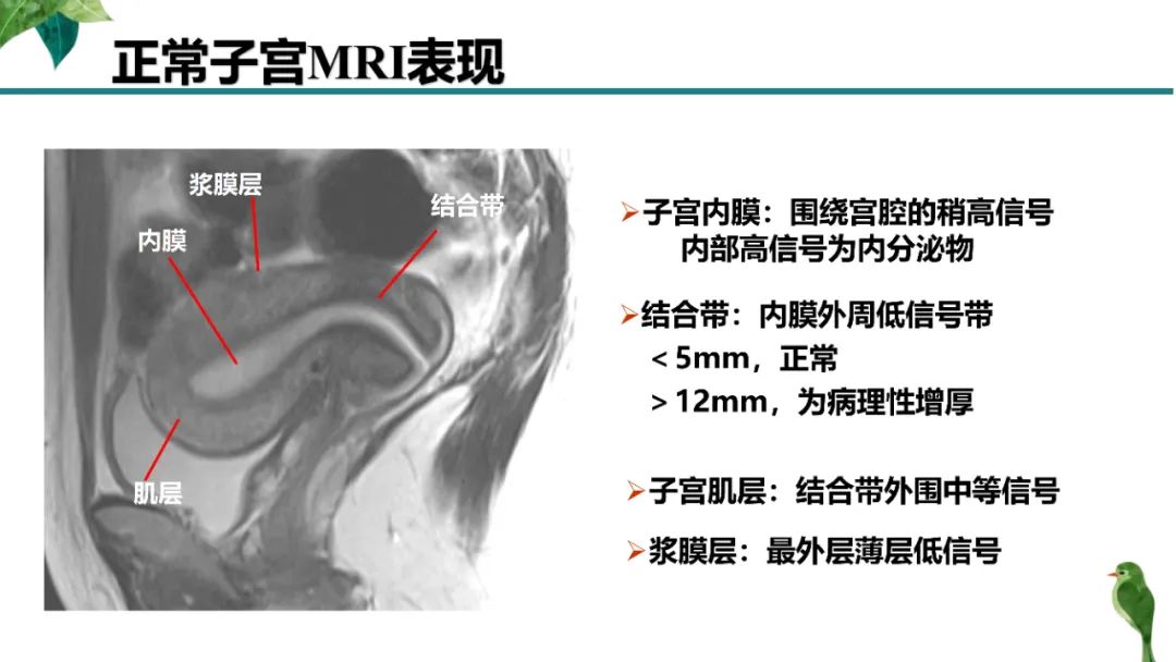 影像PPT - 【PPT】子宫内膜病变MRI诊断-9
