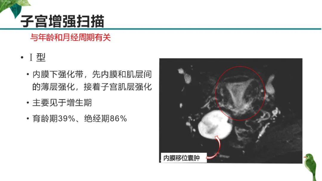 影像PPT - 【PPT】子宫内膜病变MRI诊断-15