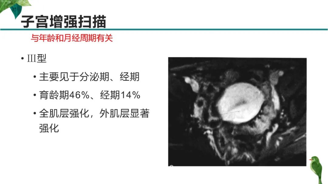 影像PPT - 【PPT】子宫内膜病变MRI诊断-17