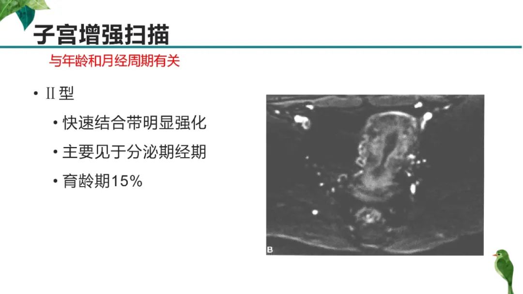 影像PPT - 【PPT】子宫内膜病变MRI诊断-16