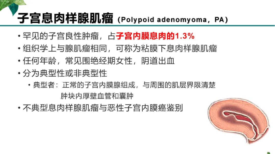 影像PPT - 【PPT】子宫内膜病变MRI诊断-60