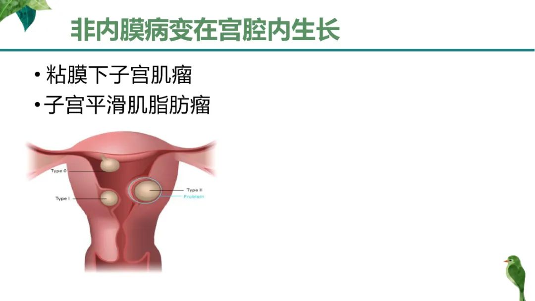 影像PPT - 【PPT】子宫内膜病变MRI诊断-73