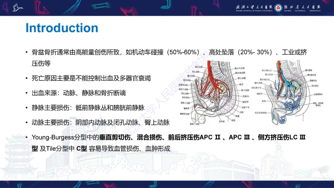 影像PPT - 【PPT】骨盆骨折合并血管损伤CT诊断-2