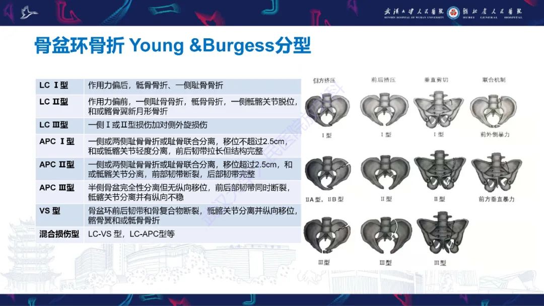 影像PPT - 【PPT】骨盆骨折合并血管损伤CT诊断-3