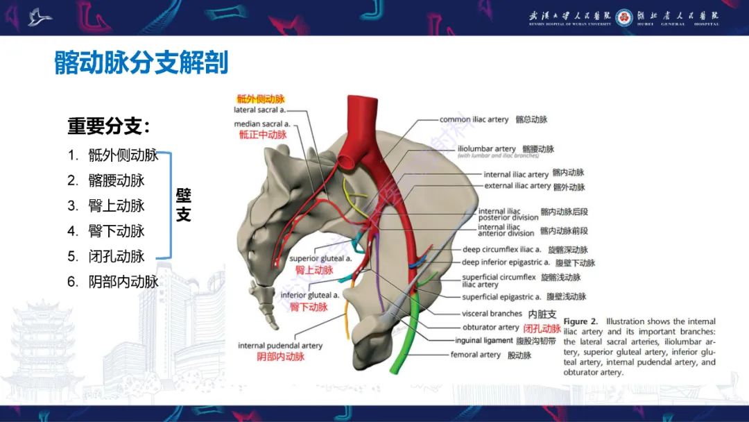 影像PPT - 【PPT】骨盆骨折合并血管损伤CT诊断-7