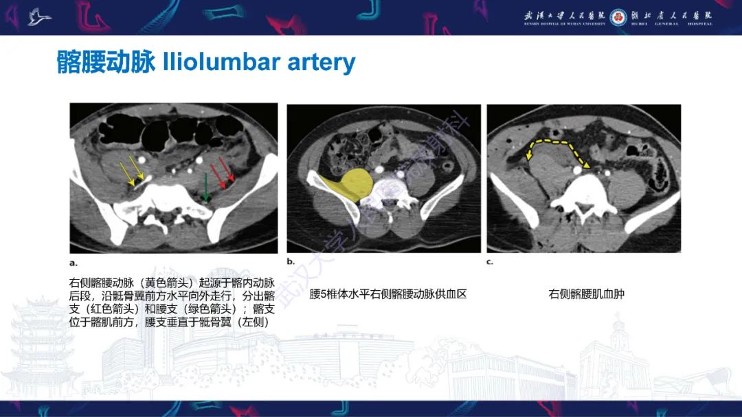 影像PPT - 【PPT】骨盆骨折合并血管损伤CT诊断-9
