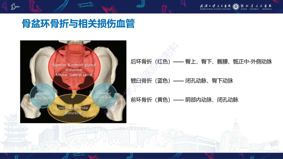 影像PPT - 【PPT】骨盆骨折合并血管损伤CT诊断-21