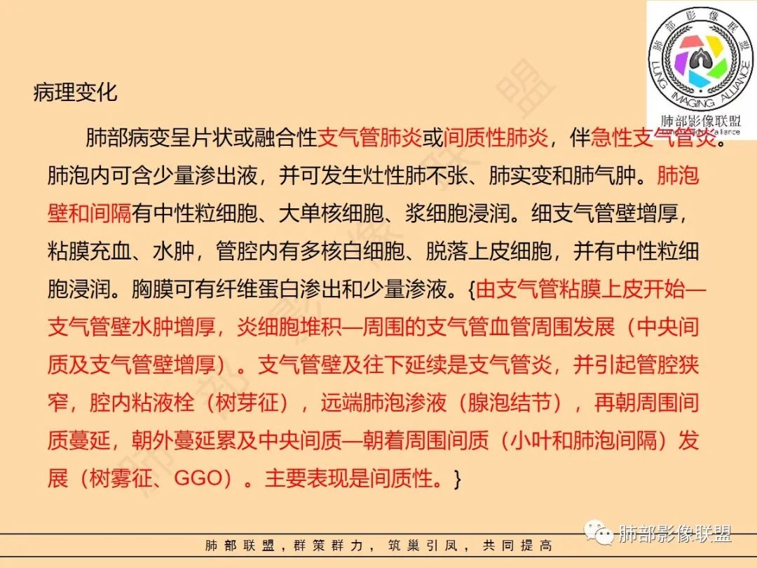 影像PPT - 【PPT】肺炎支原体肺炎影像分析-6 影像PPT - 【PPT】肺炎支原体肺炎影像分析-6