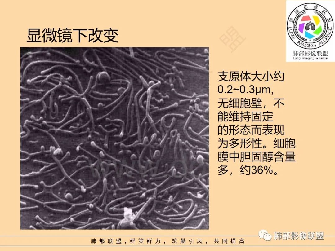 影像PPT - 【PPT】肺炎支原体肺炎影像分析-8 影像PPT - 【PPT】肺炎支原体肺炎影像分析-8