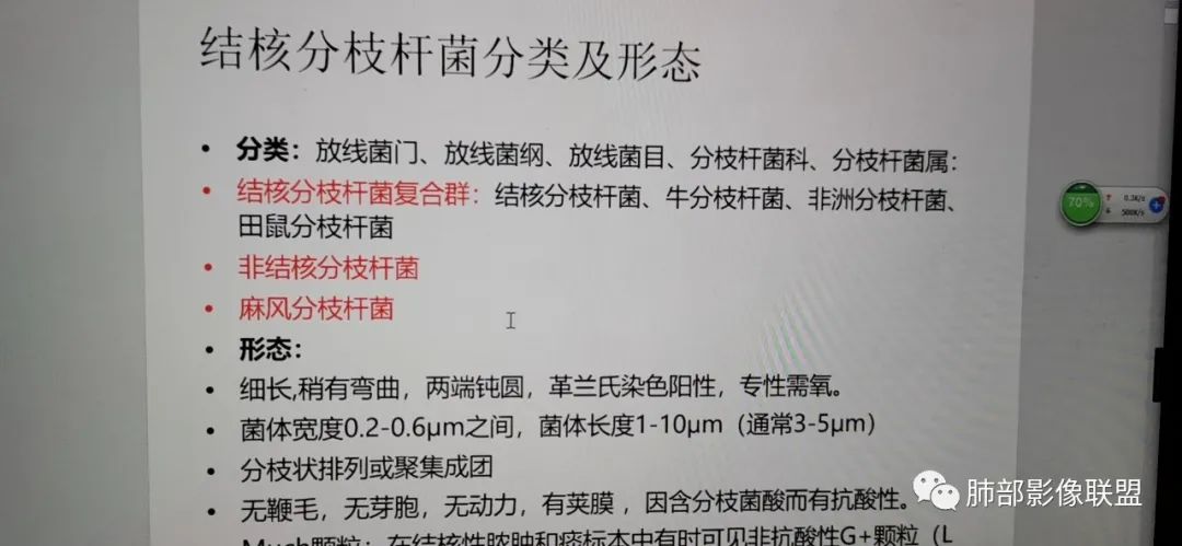 影像PPT - 【病例】支原体肺炎与肺结核的鉴别-25 影像PPT - 【病例】支原体肺炎与肺结核的鉴别-25