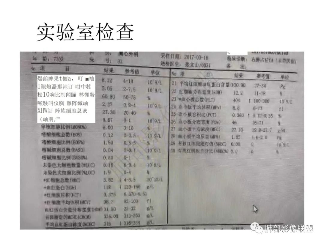影像PPT - 【病例】肺放线菌病一例CT-3 影像PPT - 【病例】肺放线菌病一例CT-3