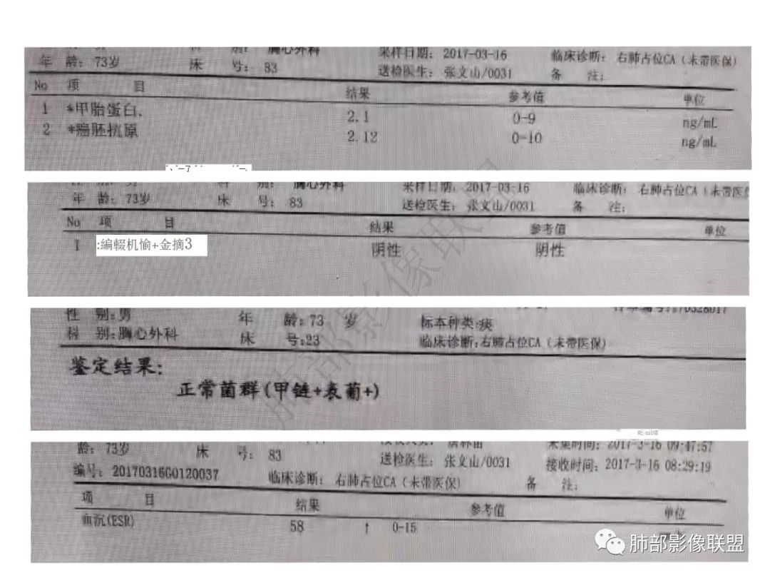 影像PPT - 【病例】肺放线菌病一例CT-4 影像PPT - 【病例】肺放线菌病一例CT-4