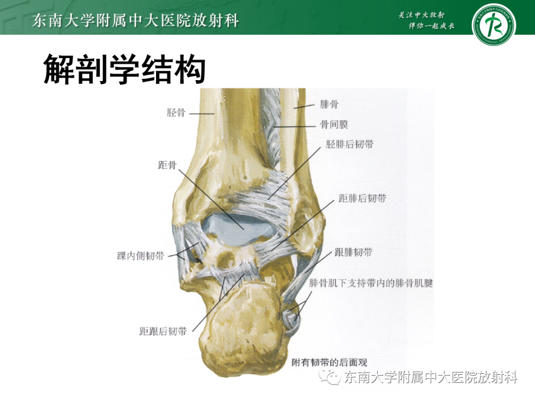 影像PPT - 【PPT】下胫腓联合损伤-8