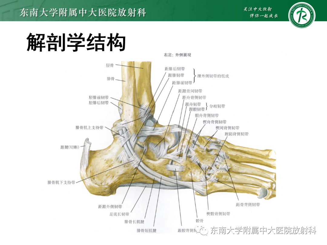 影像PPT - 【PPT】下胫腓联合损伤-9