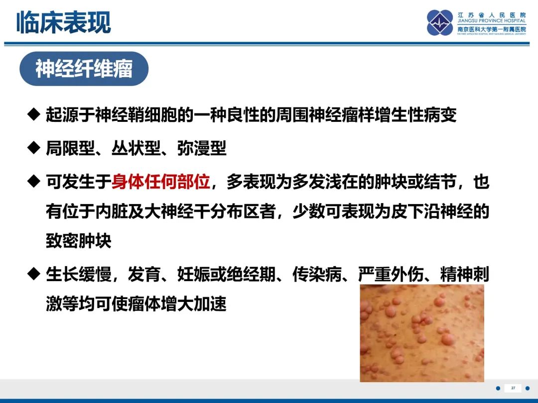 影像PPT - 【PPT】神经纤维瘤病1型-28